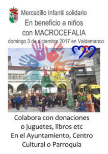 ValdemancoMacrocefalia17