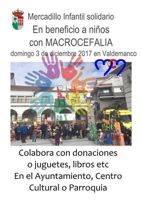 ValdemancoMacrocefalia17